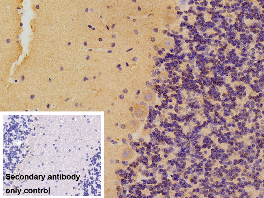Monoclonal Antibody to Tubulin Beta 3 (TUBb3)