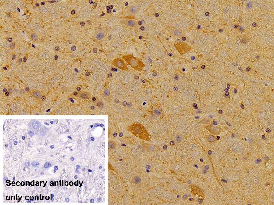 Monoclonal Antibody to Tubulin Beta 3 (TUBb3)