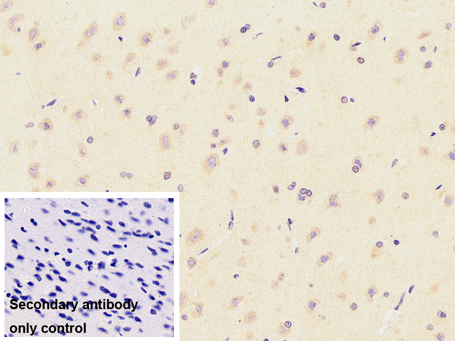 Monoclonal Antibody to Tubulin Beta 3 (TUBb3)