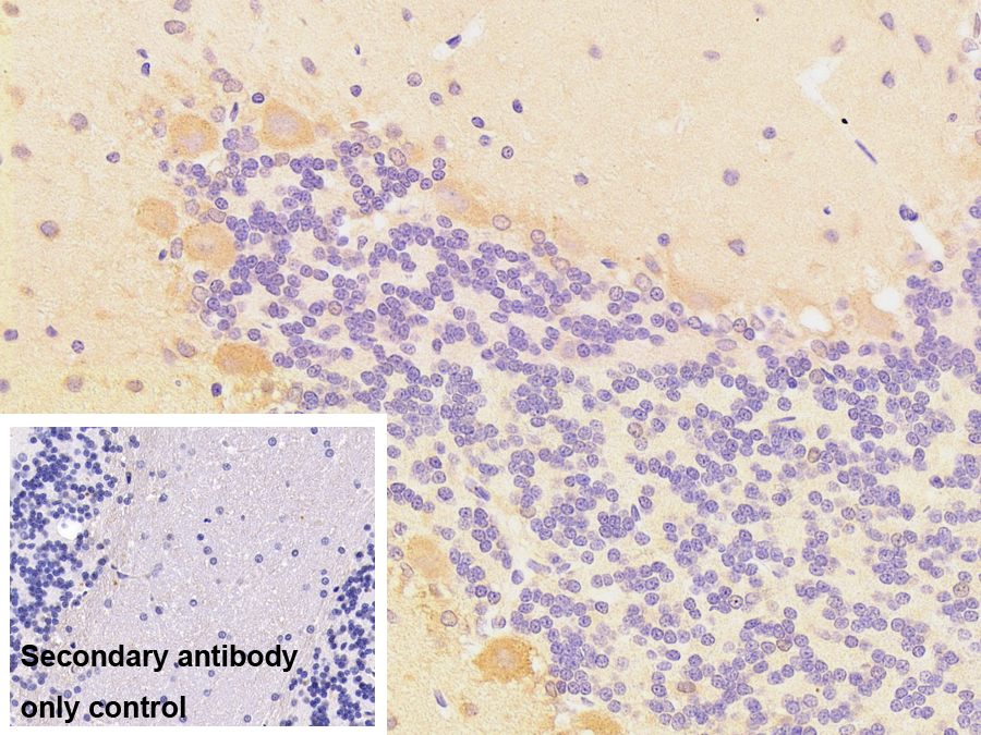 Monoclonal Antibody to Tubulin Beta 3 (TUBb3)
