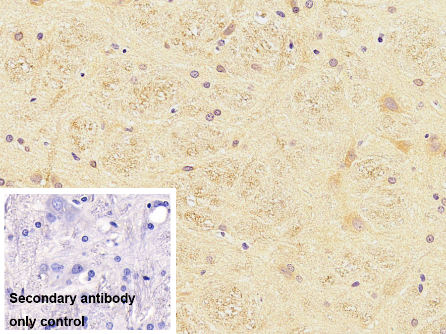 Monoclonal Antibody to Tubulin Beta 3 (TUBb3)