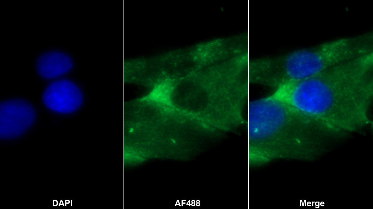 Monoclonal Antibody to Tau-Tubulin Kinase 2 (tTBK2)