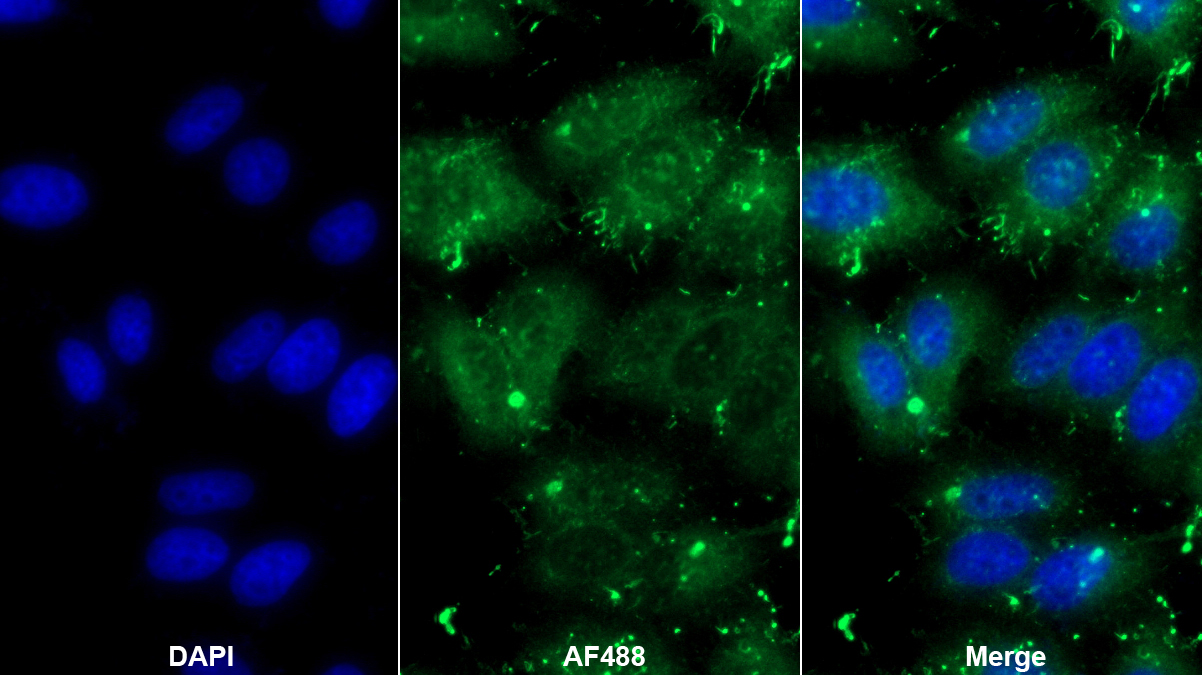 Monoclonal Antibody to Annexin A4 (ANXA4)