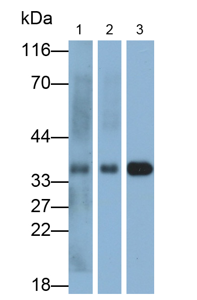 Monoclonal Antibody to Annexin A3 (ANXA3)