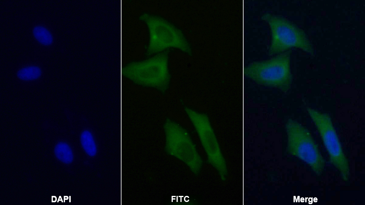 Monoclonal Antibody to Annexin A3 (ANXA3)