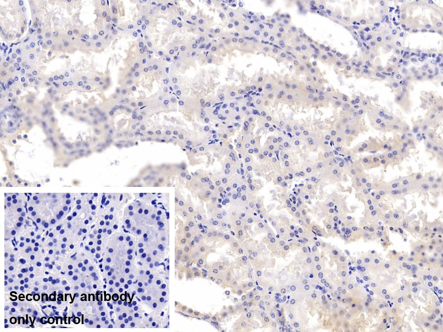 Monoclonal Antibody to Annexin A3 (ANXA3)