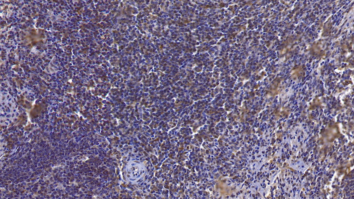 Monoclonal Antibody to Annexin A3 (ANXA3)