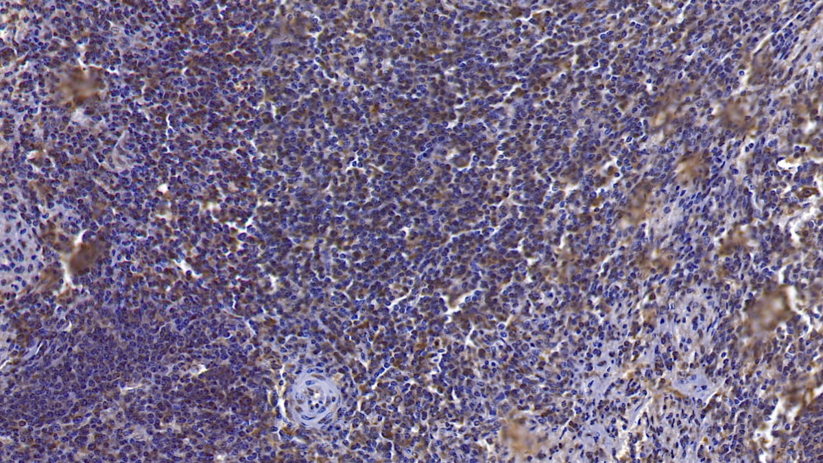 Monoclonal Antibody to Annexin A3 (ANXA3)