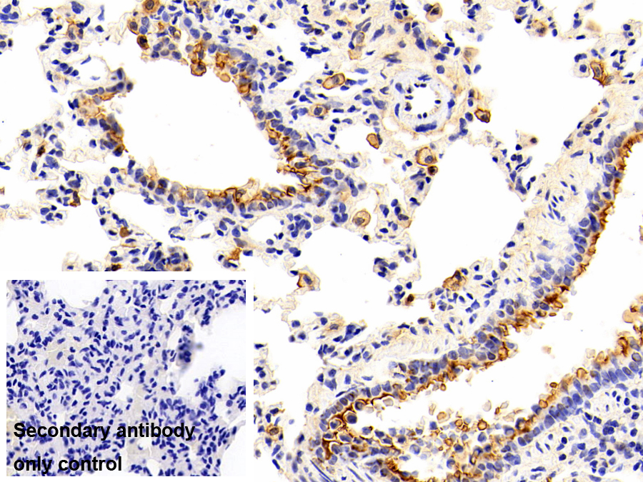 Monoclonal Antibody to Annexin A1 (ANXA1)