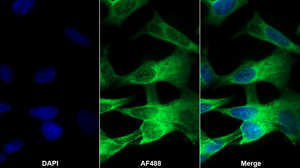 Monoclonal Antibody to Glutamate Receptor, Ionotropic, AMPA 2 (GRIA2)