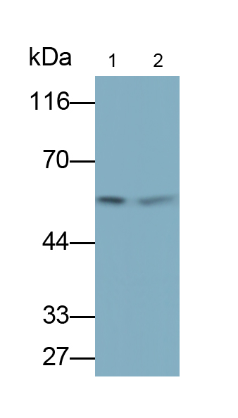 Monoclonal Antibody to Aldehyde Dehydrogenase 7 Family, Member A1 (ALDH7A1)