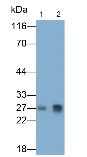Monoclonal Antibody to Complement Component 1, Q Subcomponent C (C1qC)