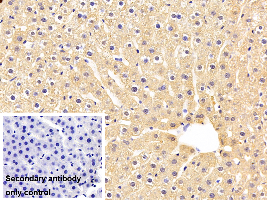 Monoclonal Antibody to Complement Component 1, Q Subcomponent C (C1qC)