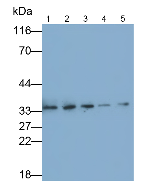 Monoclonal Antibody to Serine/Arginine Rich Splicing Factor 2 (SRSF2)