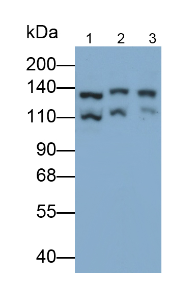 Monoclonal Antibody to Janus Kinase 2 (JAK2)