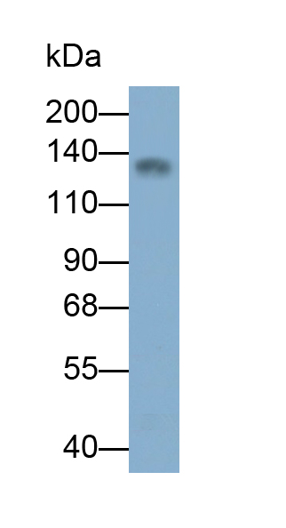 Monoclonal Antibody to Janus Kinase 2 (JAK2)