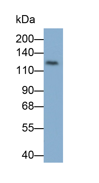 Monoclonal Antibody to Janus Kinase 2 (JAK2)