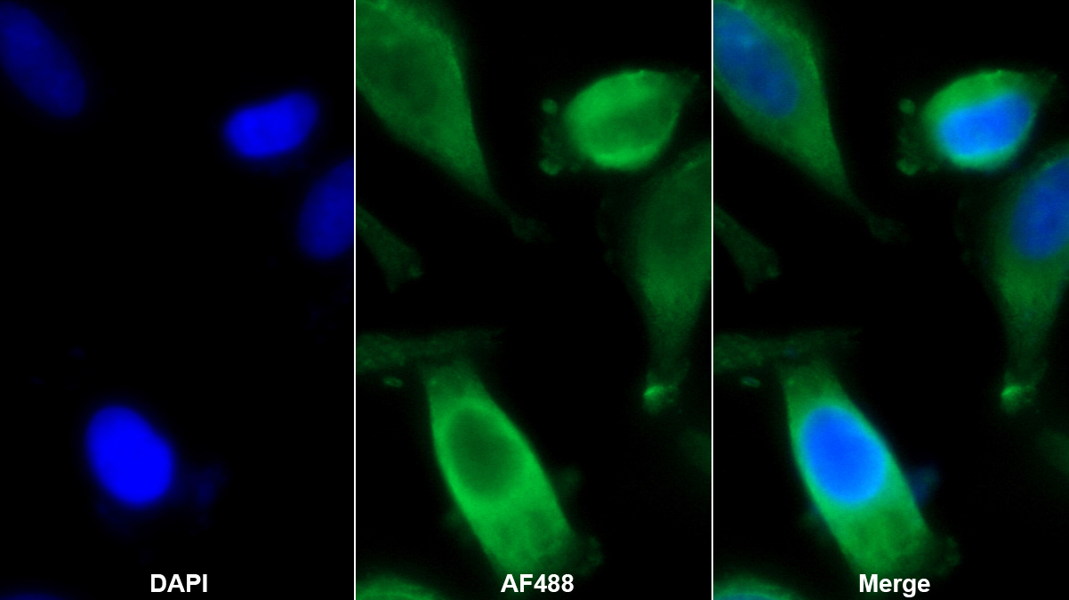 Monoclonal Antibody to Tumor Necrosis Factor Alpha Induced Protein 3 Interacting Protein 1 (TNIP1)