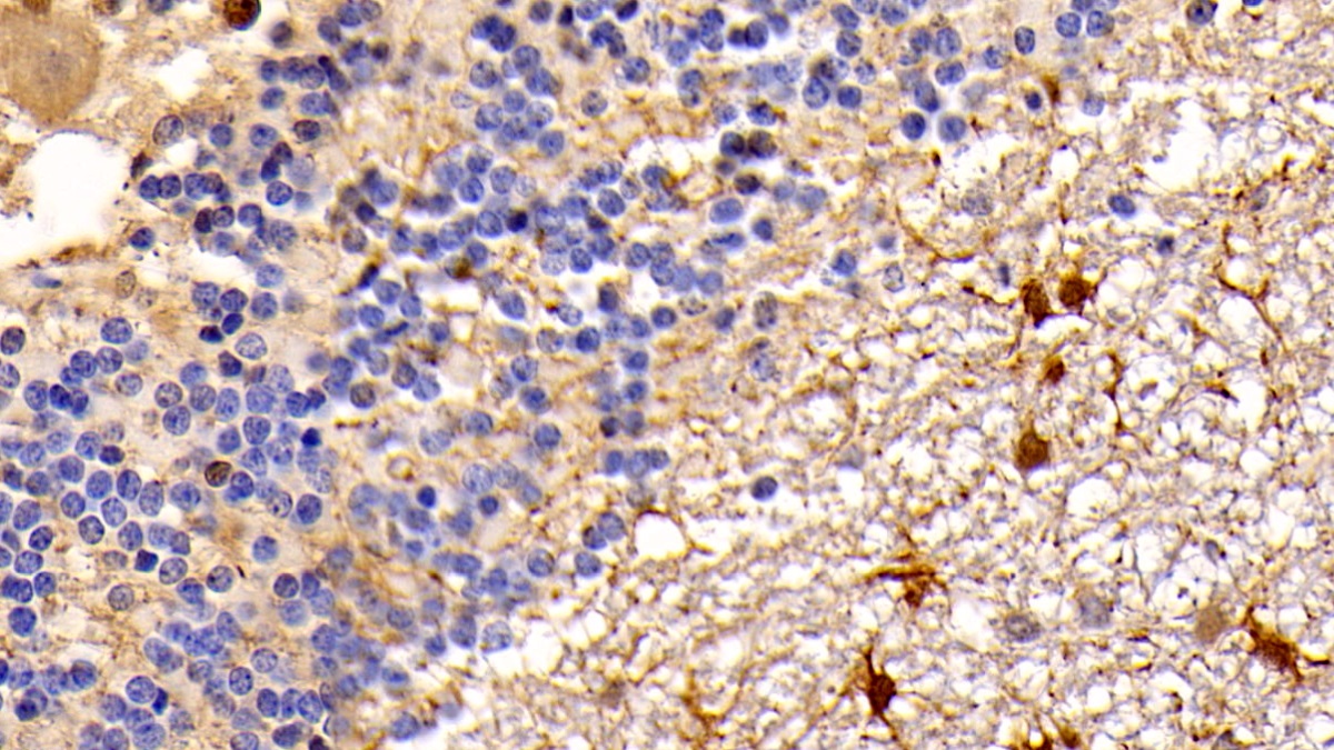 Monoclonal Antibody to Phosphatase And Tensin Homolog (PTEN)