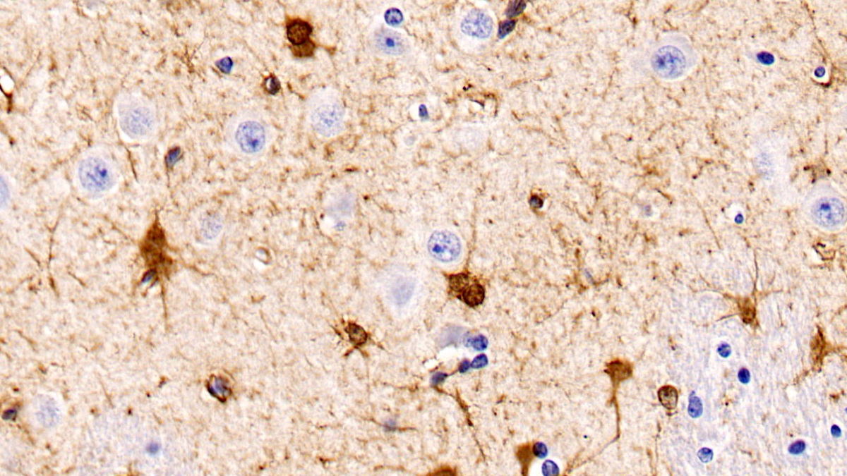 Monoclonal Antibody to Phosphatase And Tensin Homolog (PTEN)
