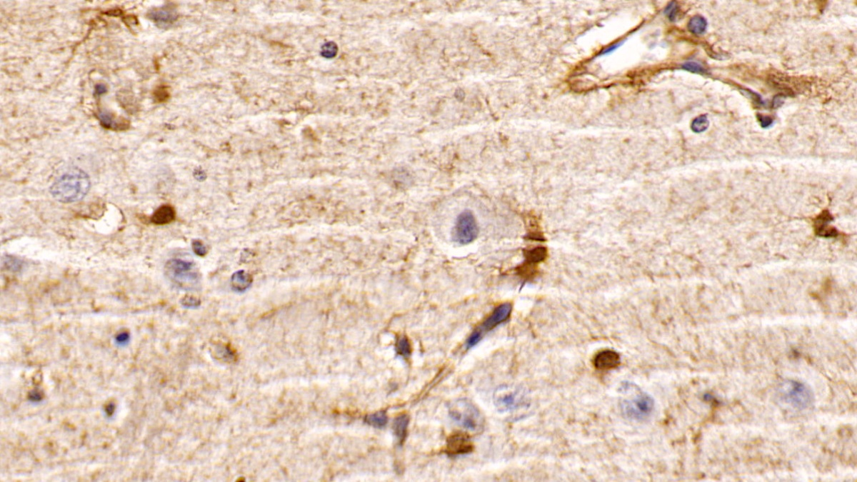 Monoclonal Antibody to Phosphatase And Tensin Homolog (PTEN)