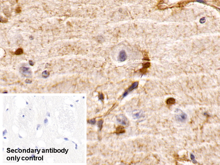 Monoclonal Antibody to Phosphatase And Tensin Homolog (PTEN)