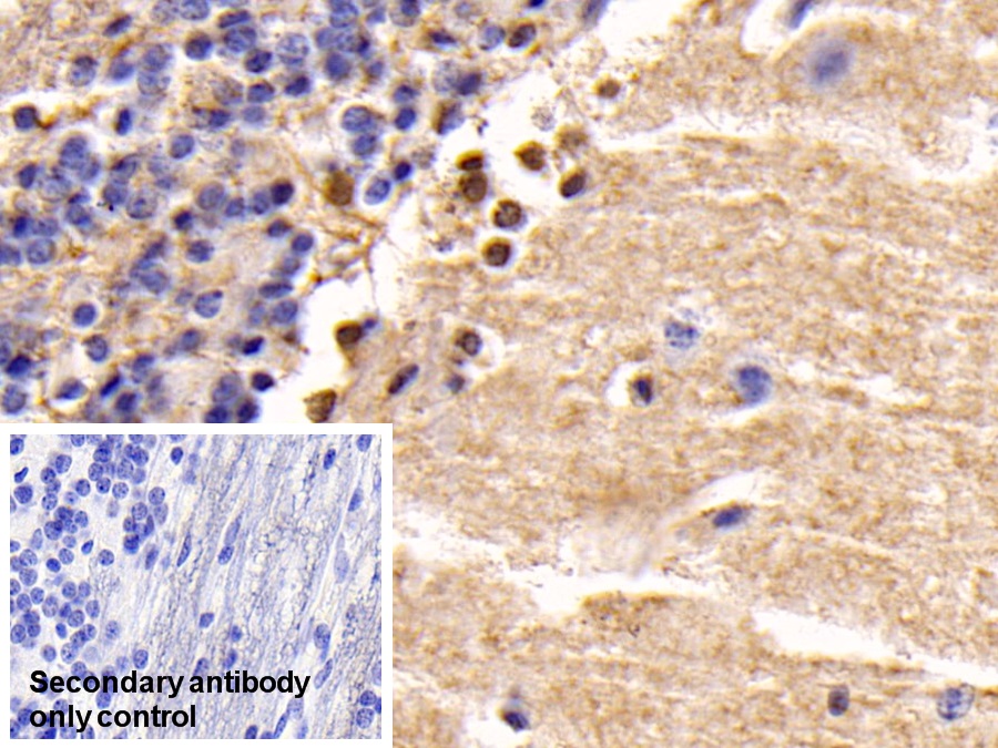 Monoclonal Antibody to Phosphatase And Tensin Homolog (PTEN)