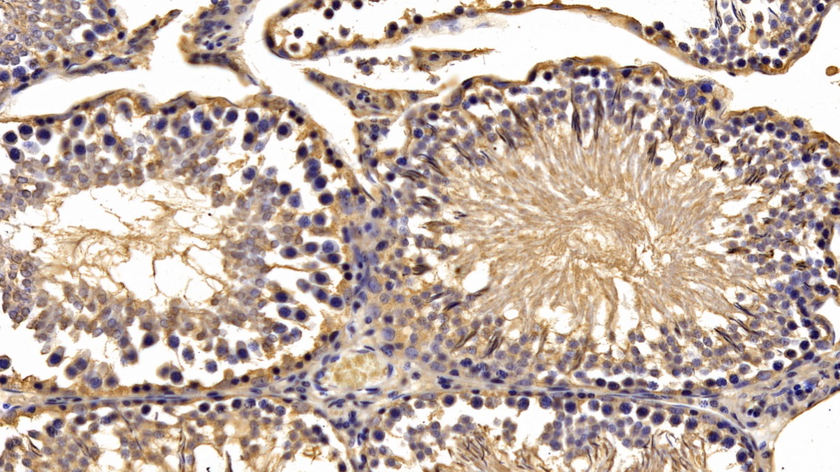 Monoclonal Antibody to Secreted Frizzled Related Protein 1 (SFRP1)