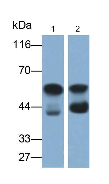 Monoclonal Antibody to Purinergic Receptor P2X, Ligand Gated Ion Channel 7 (P2RX7)
