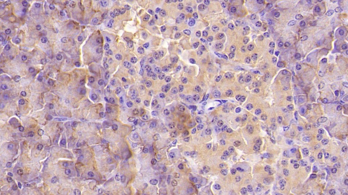 Monoclonal Antibody to Aspartate Beta Hydroxylase (ASPH)