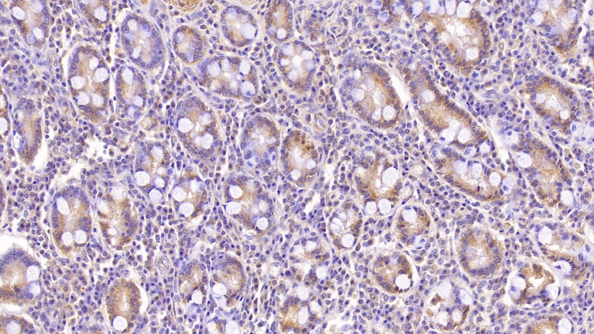 Monoclonal Antibody to Aspartate Beta Hydroxylase (ASPH)