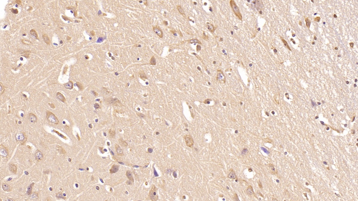 Monoclonal Antibody to Aspartate Beta Hydroxylase (ASPH)