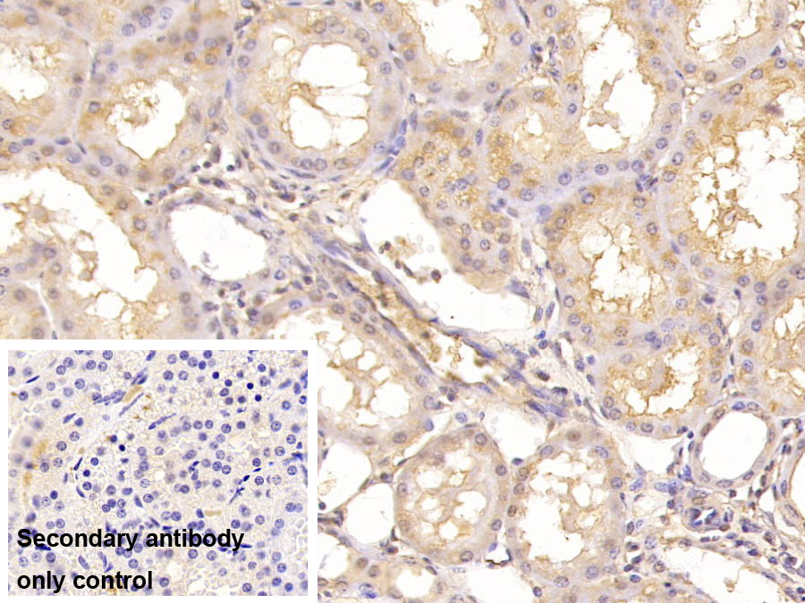 Monoclonal Antibody to Aspartate Beta Hydroxylase (ASPH)
