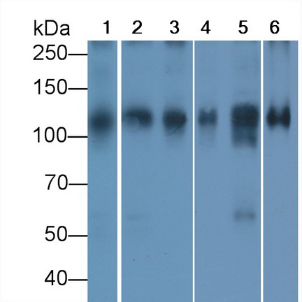 Monoclonal Antibody to ATPase, Na+/K+ Transporting Alpha 1 Polypeptide (ATP1a1)