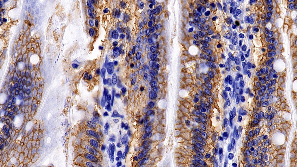 Monoclonal Antibody to ATPase, Na+/K+ Transporting Alpha 1 Polypeptide (ATP1a1)