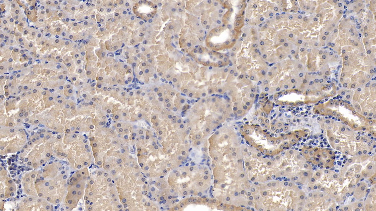 Monoclonal Antibody to ATPase, Na+/K+ Transporting Alpha 1 Polypeptide (ATP1a1)