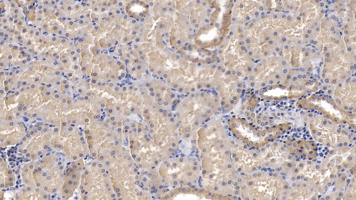 Monoclonal Antibody to ATPase, Na+/K+ Transporting Alpha 1 Polypeptide (ATP1a1)