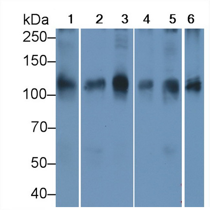 Monoclonal Antibody to ATPase, Na+/K+ Transporting Alpha 1 Polypeptide (ATP1a1)