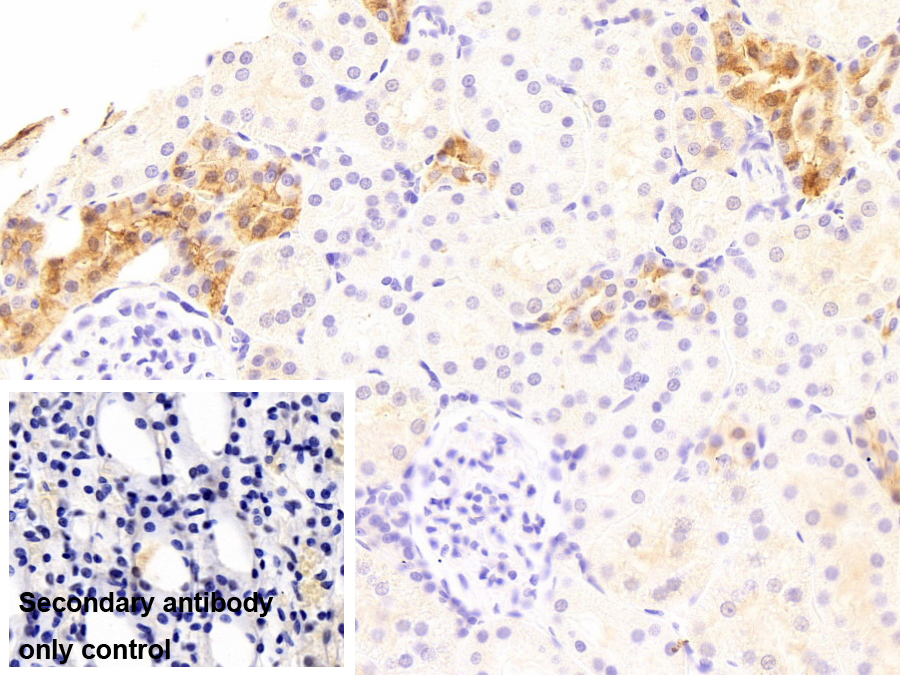 Monoclonal Antibody to Calbindin (CALB)