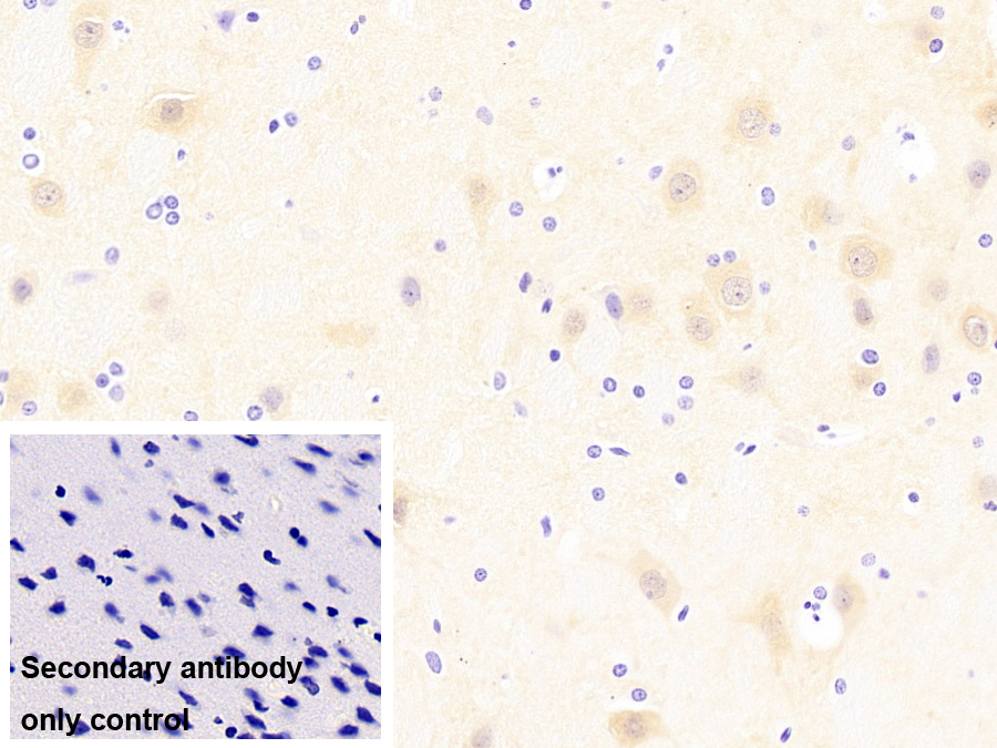 Monoclonal Antibody to Ubiquitin Carboxyl Terminal Hydrolase L1 (UCHL1)