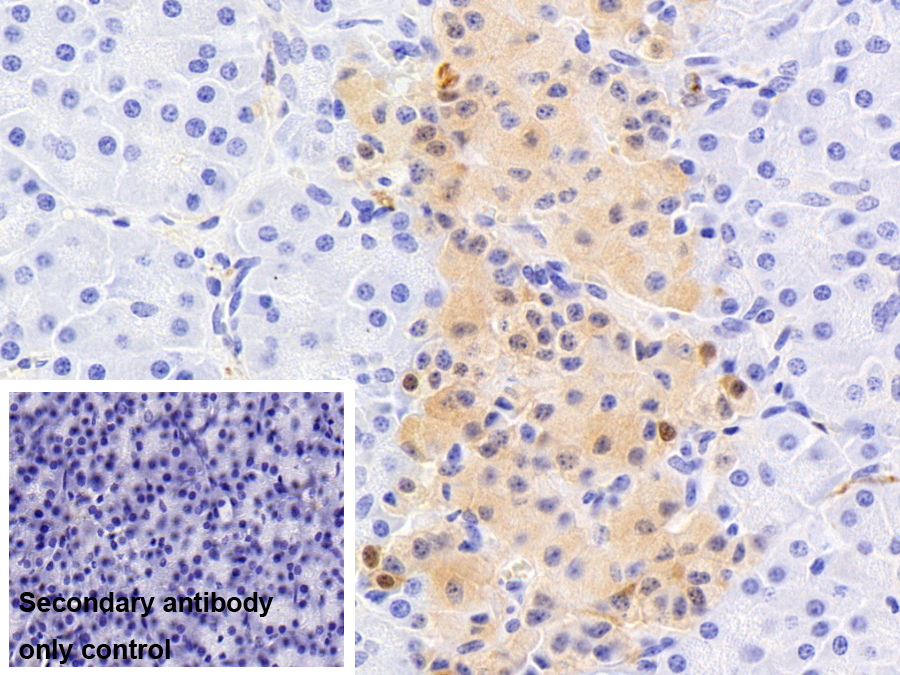 Monoclonal Antibody to Ubiquitin Carboxyl Terminal Hydrolase L1 (UCHL1)