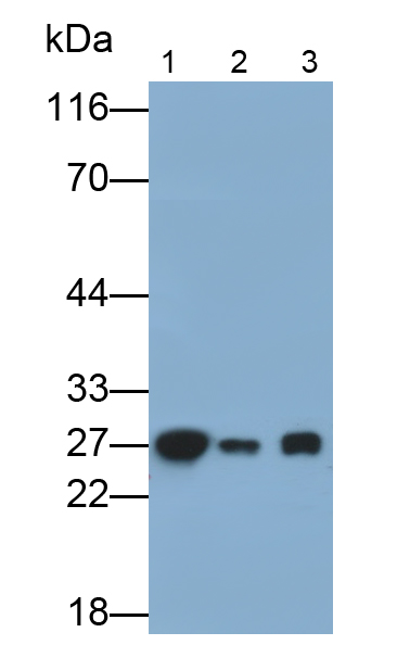 Monoclonal Antibody to Ubiquitin Carboxyl Terminal Hydrolase L1 (UCHL1)
