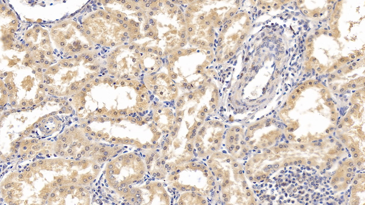 Monoclonal Antibody to Interferon Alpha 21 (IFNa21)