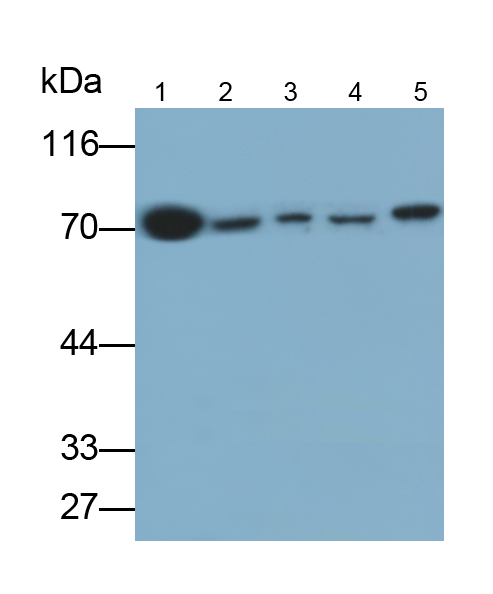 Monoclonal Antibody to Transketolase (TKT)