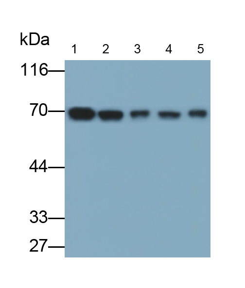 Monoclonal Antibody to Transketolase (TKT)
