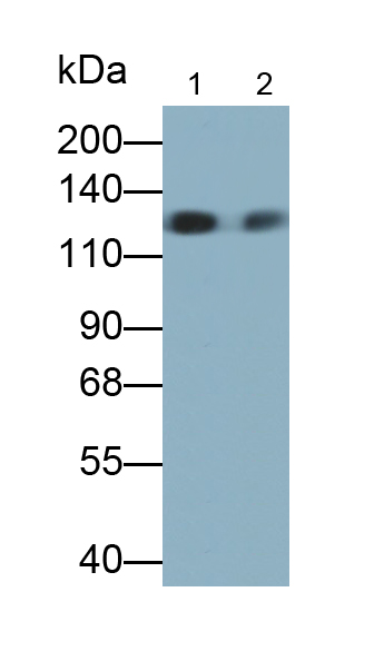 Monoclonal Antibody to Inter Alpha-Globulin Inhibitor H4 (ITIH4)