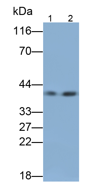 Monoclonal Antibody to Lymphatic Vessel Endothelial Hyaluronan Receptor 1 (LYVE1)