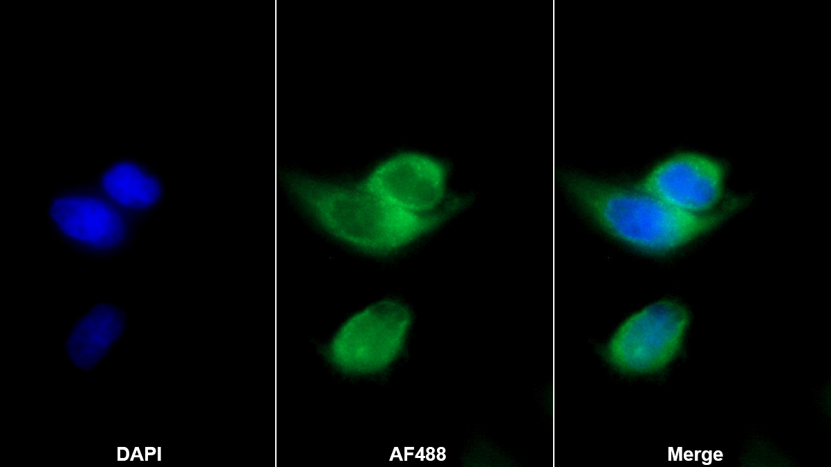 Monoclonal Antibody to Calponin 2 (CNN2)