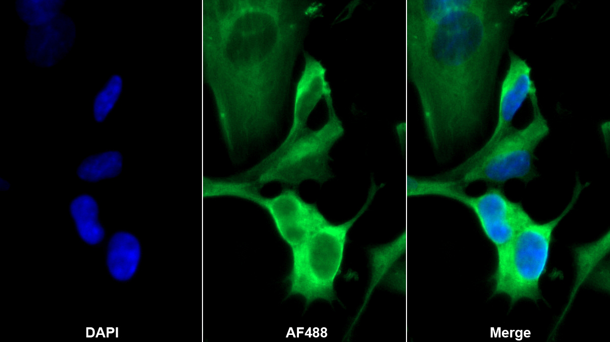 Monoclonal Antibody to Ceramide Kinase (CERK)