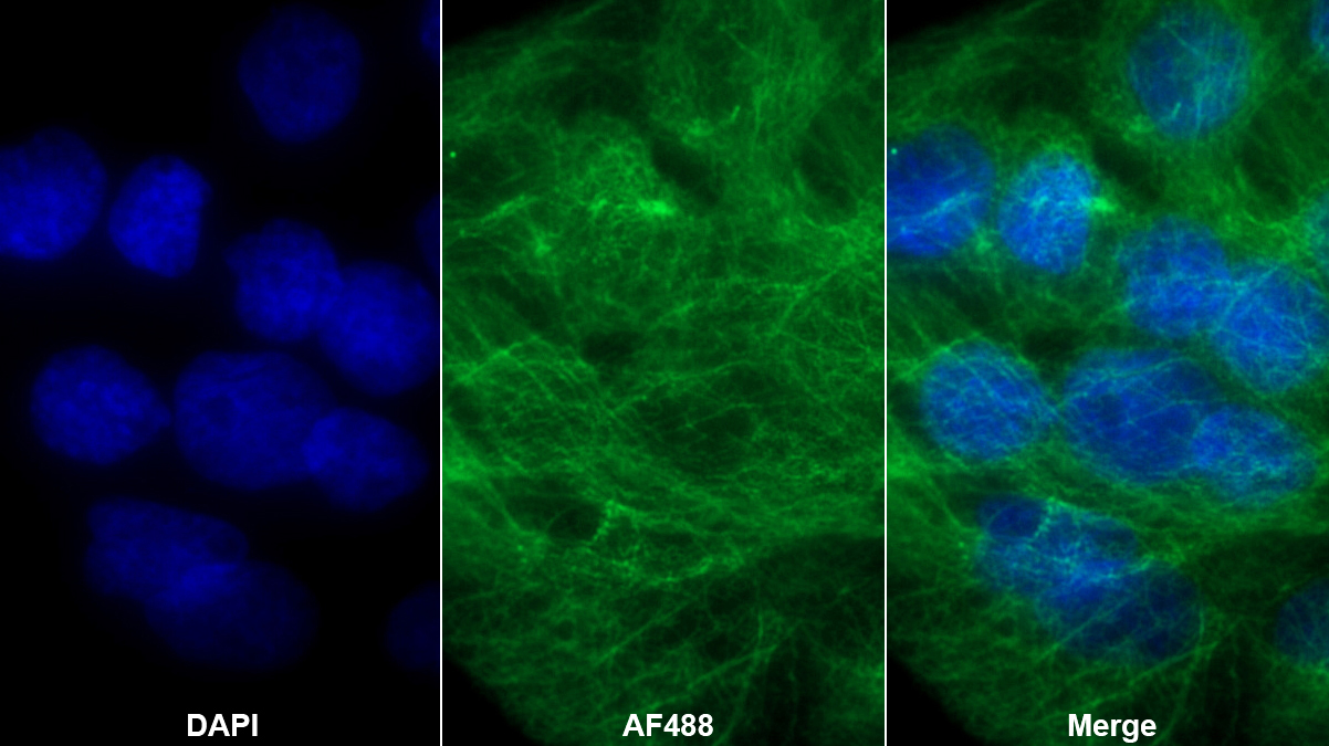 Monoclonal Antibody to Lecithin Cholesterol Acyltransferase (LCAT)